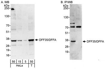 Rabbit DFF35/DFFA Antibody