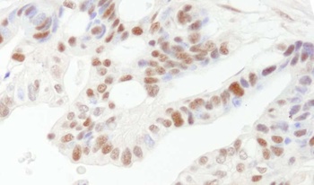 Rabbit anti-DFF45/DFFA Antibody