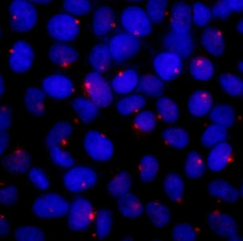 Rabbit anti-CEP131/AZ1 Antibody
