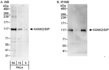 KANK2/SIP Antibody