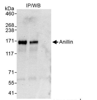 Rabbit Anillin Antibody