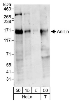 Rabbit Anillin Antibody