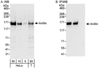 Rabbit Anillin Antibody