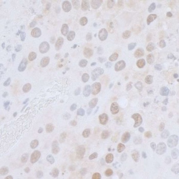 Rabbit anti-CTR9 Antibody