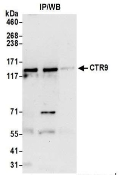 CTR9 Antibody