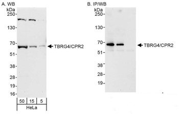 Rabbit TBRG4/CPR2 Antibody