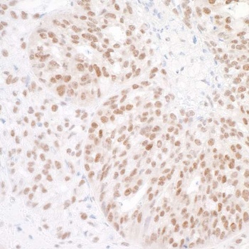 BAF53A Antibody