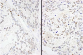 Rabbit anti-ANKS3 Antibody