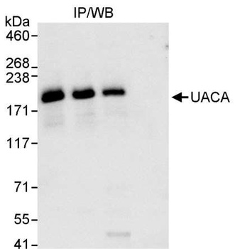 UACA Antibody
