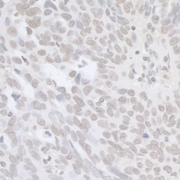 Rabbit BRCA1 Antibody