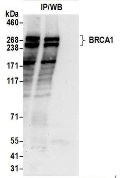 Rabbit BRCA1 Antibody