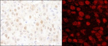 Rabbit anti-PARP1 Antibody