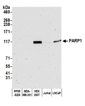 Rabbit anti-PARP1 Antibody