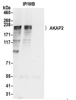 Rabbit anti-AKAP2 Antibody