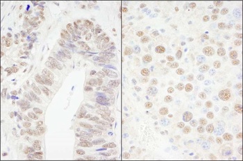 Rabbit CPSF68 Antibody
