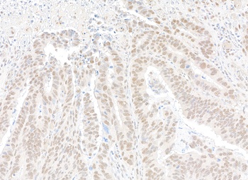 Rabbit CPSF68 Antibody