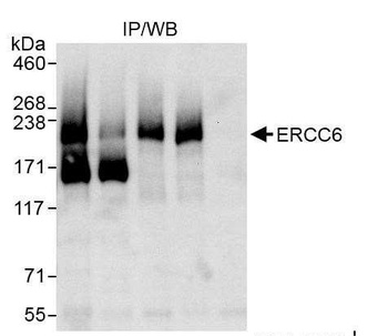 Rabbit anti-CSB/ERCC6 Antibody