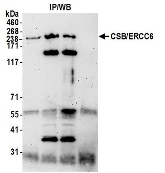 CSB/ERCC6 Antibody