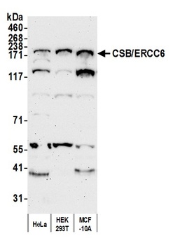 Rabbit anti-CSB/ERCC6 Antibody