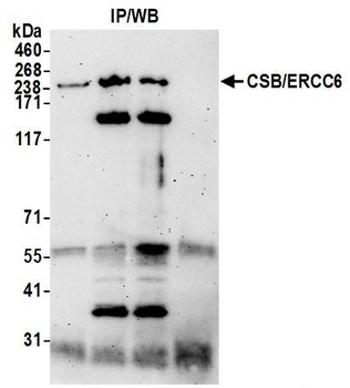 CSB/ERCC6 Antibody