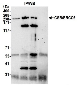 Rabbit anti-CSB/ERCC6 Antibody