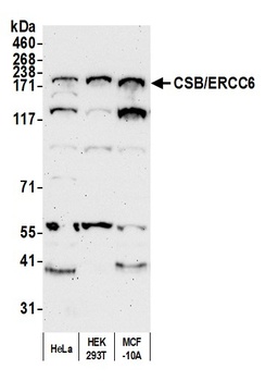 Rabbit anti-CSB/ERCC6 Antibody