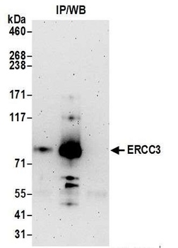 ERCC3 Antibody