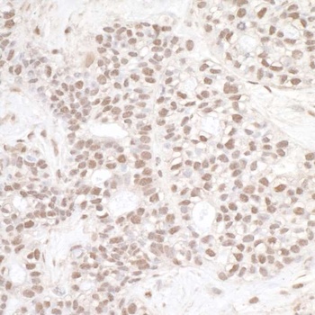 Rabbit ERCC3 Antibody