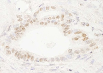 Rabbit anti-DEK Antibody