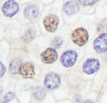 Rabbit GTF2IRD/TFII-IRD1 Antibody