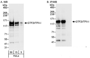 Rabbit anti-GTF2I/TFII-I Antibody