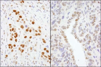 Rabbit anti-GTF2I/TFII-I Antibody