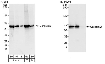 Coronin 2 Antibody