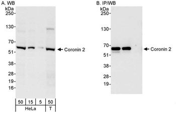 Coronin 2 Antibody