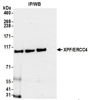 XPF/ERCC4 Antibody