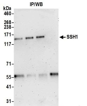 SSH1 Antibody