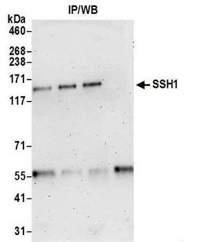Rabbit anti-SSH1 Antibody