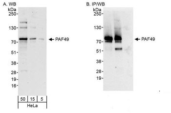 Rabbit anti-PAF49 Antibody