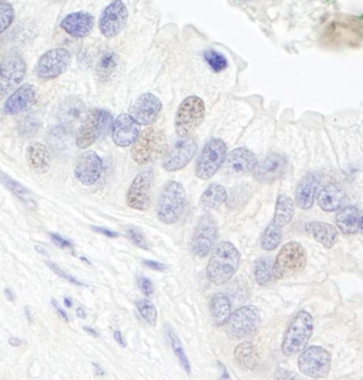 Rabbit anti-GTF3C1/TFIIIC220 Antibody