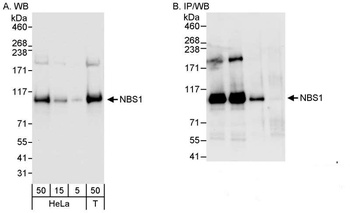 NBS1 Antibody