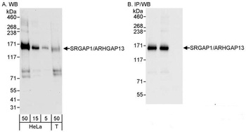Rabbit SRGAP1/ARHGAP13 Antibody