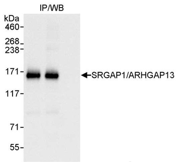 Rabbit SRGAP1/ARHGAP13 Antibody