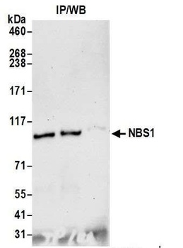 Rabbit NBS1 Antibody