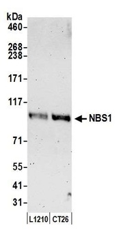 Rabbit NBS1 Antibody
