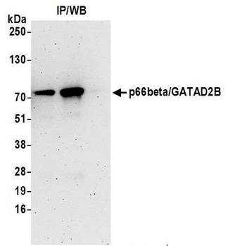 Rabbit anti-p66beta/GATAD2B Antibody