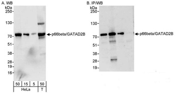 Rabbit anti-p66beta/GATAD2B Antibody