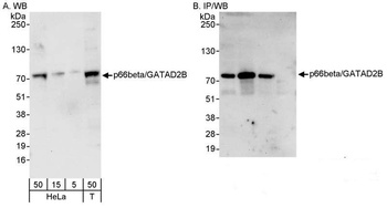 Rabbit anti-p66beta/GATAD2B Antibody
