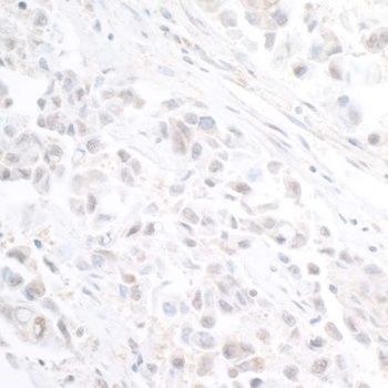 Rabbit anti-INT11 Antibody