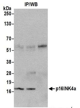 p16INK4a Antibody