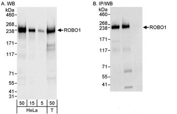 Rabbit ROBO1 Antibody